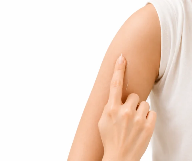 Implanon di Klinik Iris