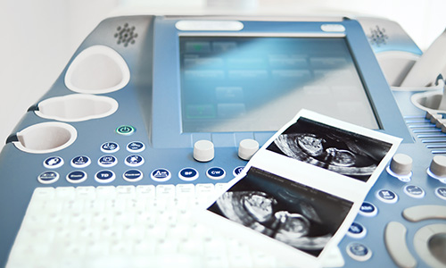Mesin ultrasound termaju di Klinik Iris